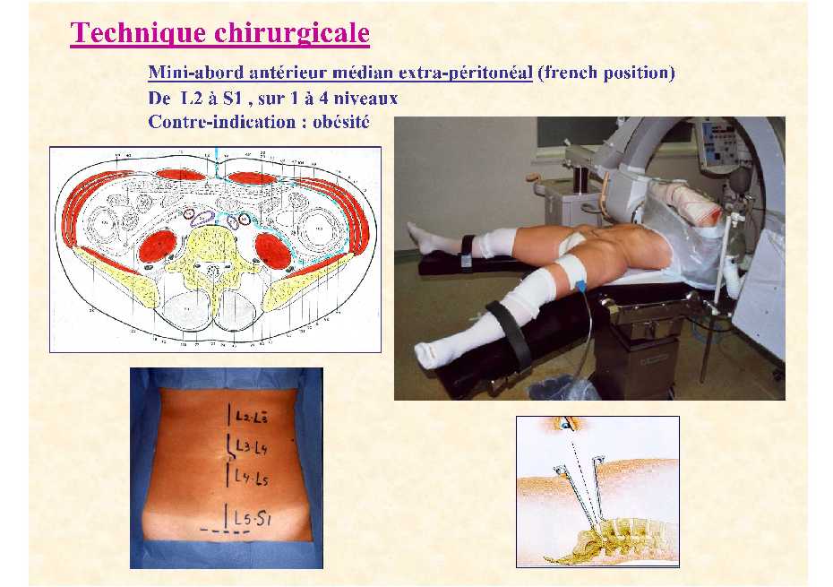 Dr. Lecomte