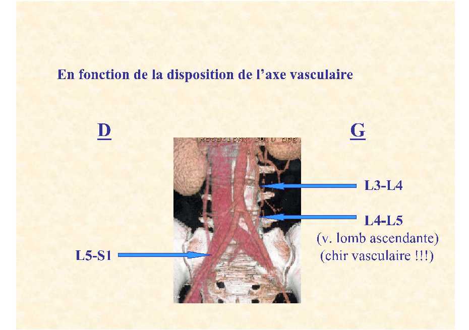 Dr. Lecomte