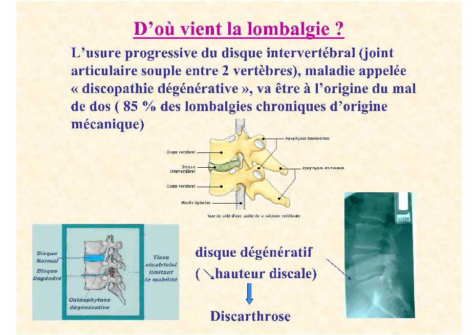 Dr. Lecomte