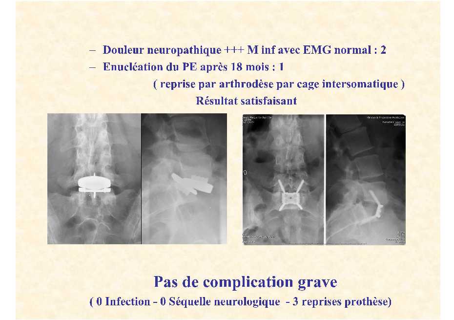 Dr. Lecomte