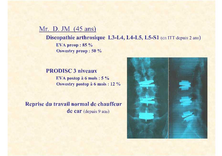 Dr. Lecomte