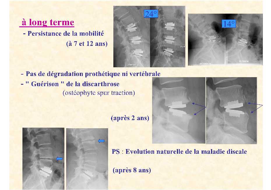 Dr. Lecomte