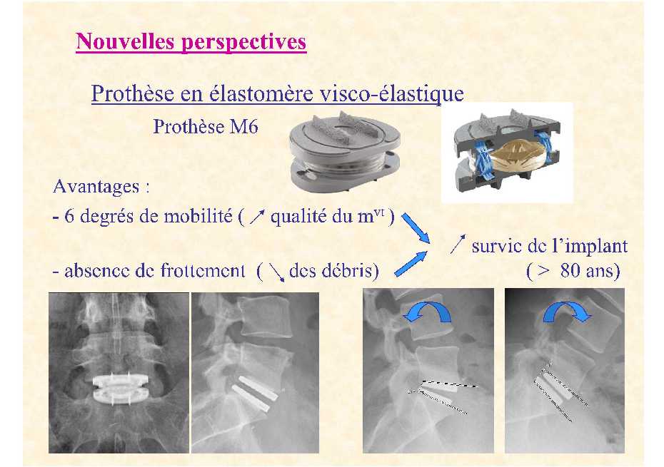 Dr. Lecomte