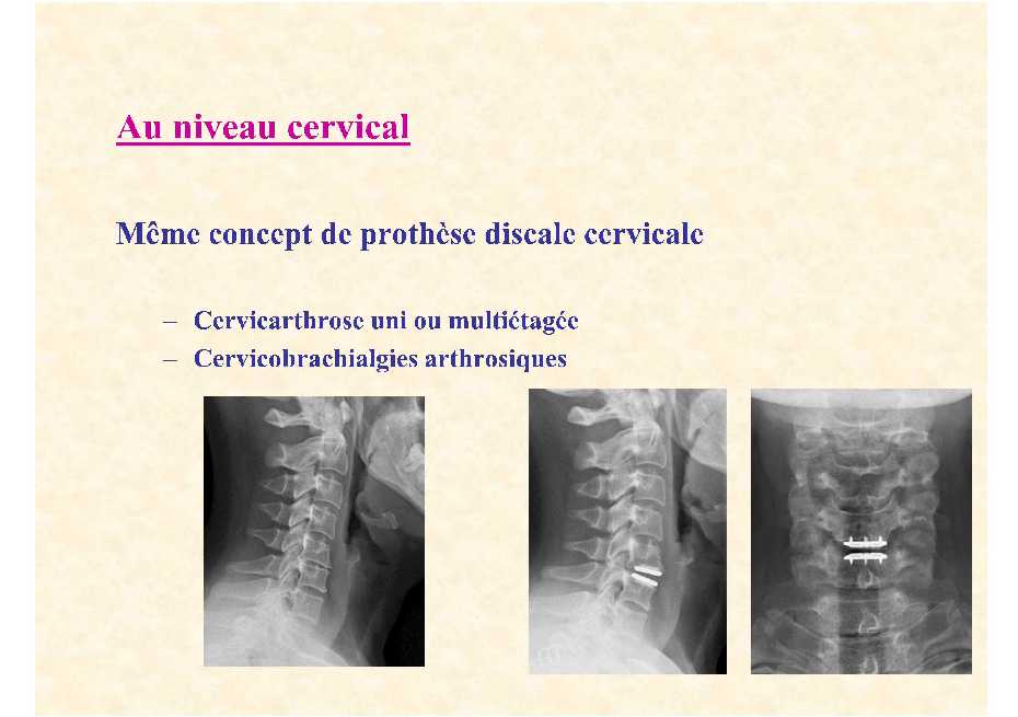 Dr. Lecomte