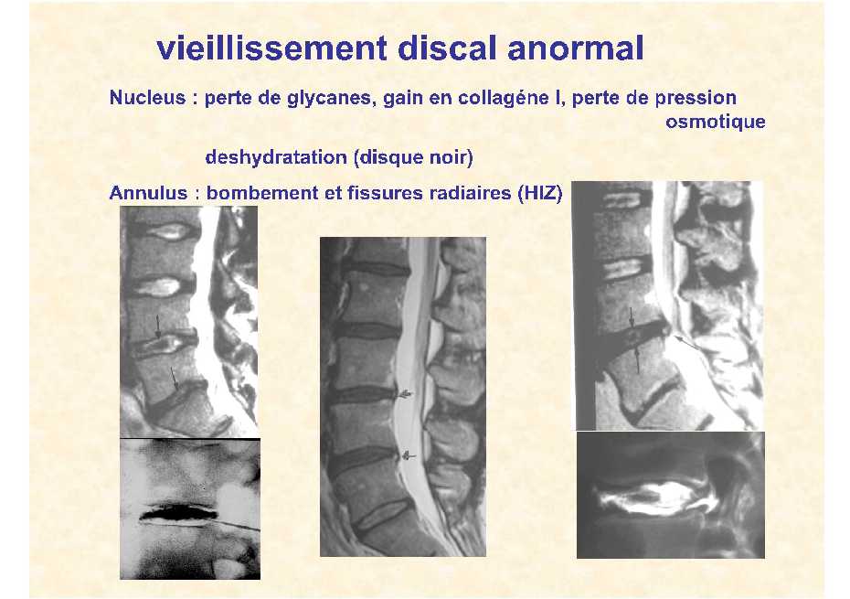 Dr. Lecomte